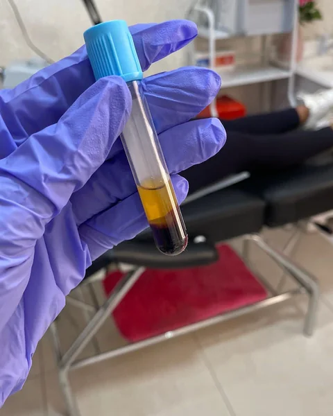 Tubo de plasma rico en plaquetas sostenido con guante